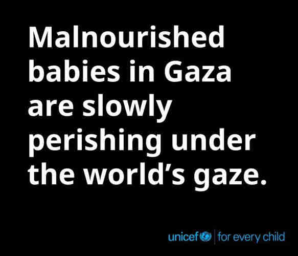 UNICEF: malnourished babies in Gaza are slowly perishing under the world's gaze.