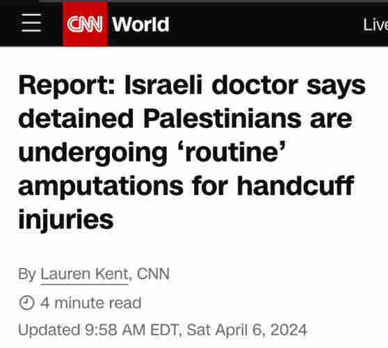 CNN World
Report: Israeli doctor saysdetained Palestinians are undergoing 'routine' amputations for handcuff injuries
By Lauren Kent, CNN
Updated 9:58 AM EDT, Sat April 6, 2024
