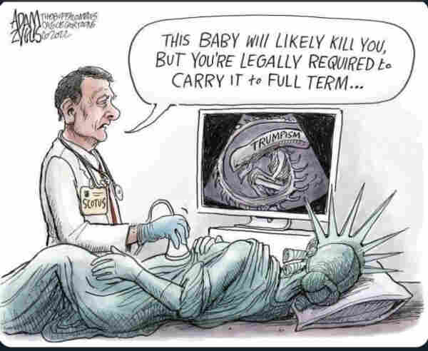 Cartoon by Adam Zyglis
Lady Liberty lies in on an exam table, her back to the viewer. The doctor, labeled "SCOTUS," stands near her, performing an ultrasound on her belly. He says, "This baby will likely kill you, but you're legally required to carry it to full term...."
