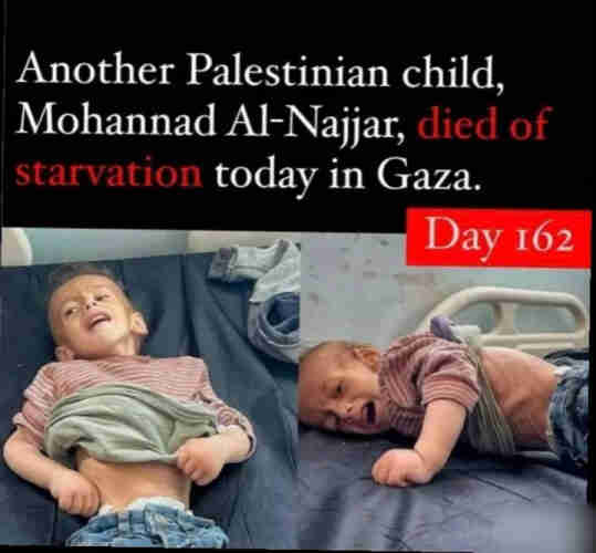 Muhammad Al-Najjar died of malnutrition in Gaza