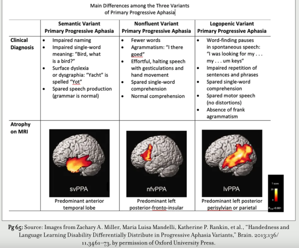 Main differences among the 3 variants of primary progressive aphasia. On the left side is clinical diagnosis and atrophy on MRI. Another column with symptoms of semantic variant primary progressive aphasia (for ex. spared speech production); then nonfluent variant primary progressive aphasia (fewer words);  then logopenic variant primary progressive aphasia (word-finding pauses).