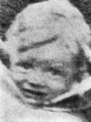 A grainy photo of the face of a little boy who looks a bit afraid - he is looking into the camera with his mouth slightly opened.
