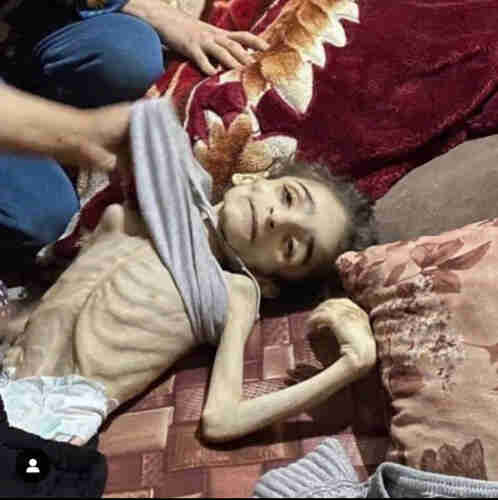 another starving palestinian child in Gaza.
does anyone care?