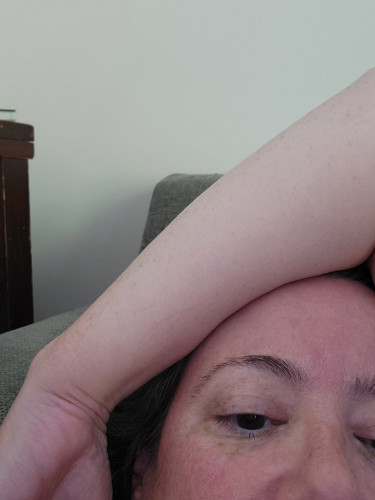 A white woman covered in freckles throws her arm dramatically over her head, which is resting against the armrest of a green sofa.