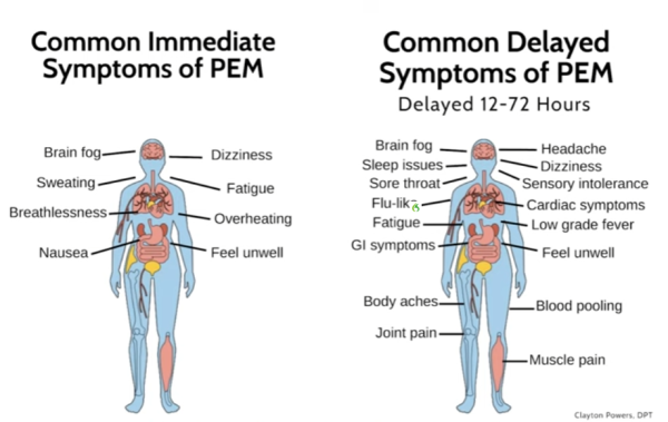 Common Immediate symptoms of PEM

Common Delayed Symptoms of PEM 
Delayed 12-72 hours
