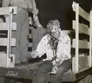 Bloodied worker sitting in the back of a truck during the Women's Day Riot.