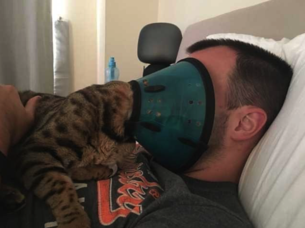 A cat has on a cone (the kind used to keep animals from picking at their stitches after surgery)

The cat rests on a man's chest and has completely covered his face with the cone so they are in there together. 