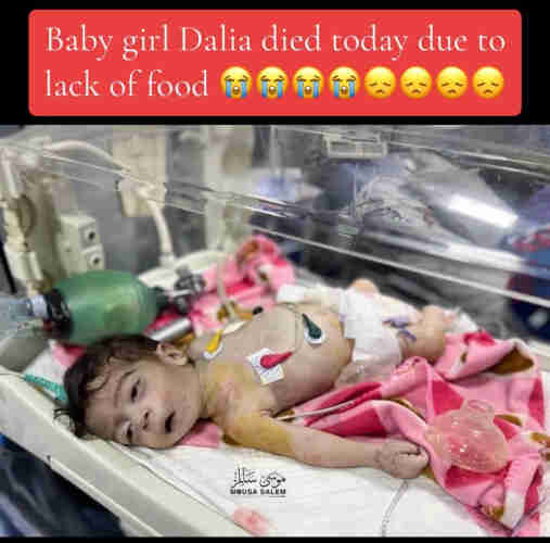 the malnourished new born baby girl Dalia died of starvation while the world stands by
